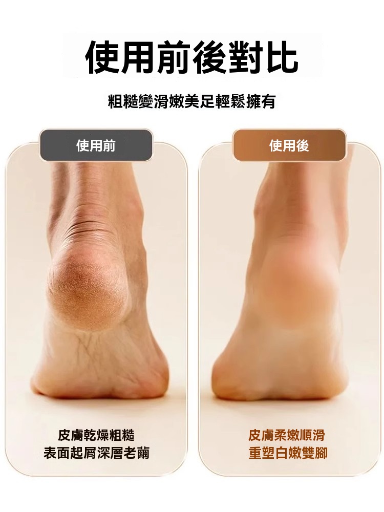 【夏日美腳必備！】電動磨腳器，高效去角質，回歸嫩滑雙足腳底“美容師”，輕鬆修繭，享受足部SPA級體驗！